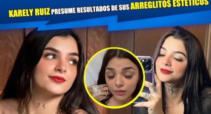 Karely Ruiz presumió la más reciente cirugía estética a la que se sometió