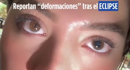 Personas aseguran tener "pupilas deformes" tras ver el eclipse solar sin protección | VIDEO